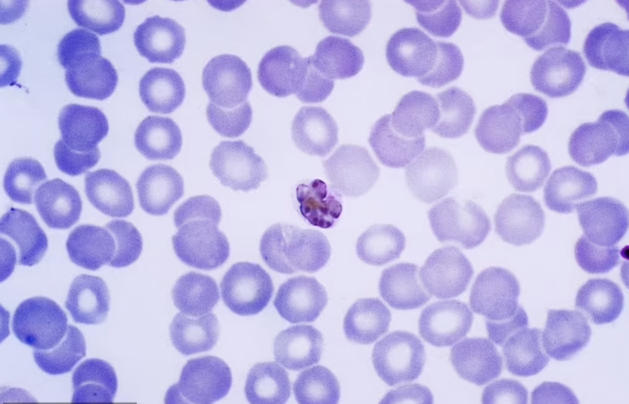 Gambar parasit malaria