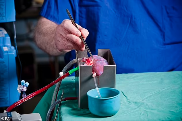 Inovasi "Merubah" Tipe Golongan Darah pada Organ Donor Ginjal