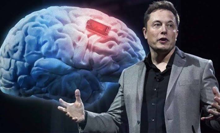 Elon Musk Lanjutkan Proyek Implan Chip ke Otak Manusia