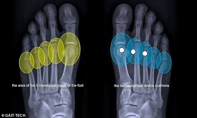 Inovasi Insole Nyaman untuk Sepatu Hak Tinggi